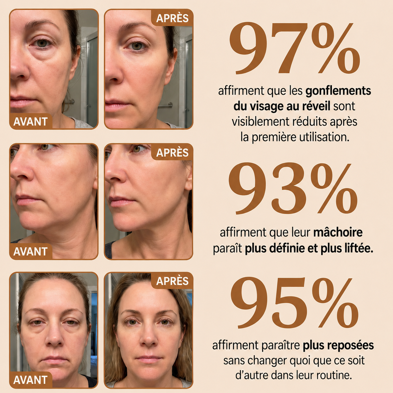 Avant et après 4 semaines — peau plus reposée et lumineuse
